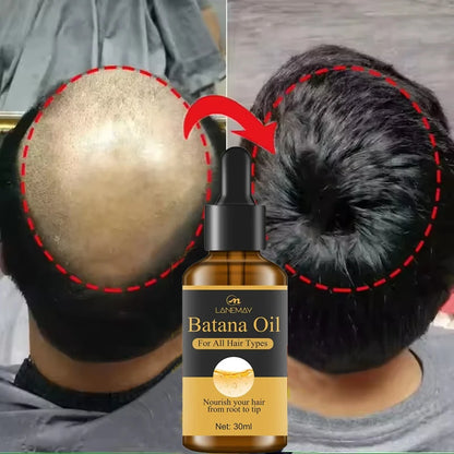 Sérum Capillaire à l'Huile de Batana – Repousse & Anti-Chute (30ml)